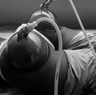 In The Buttocks Struggle, New Scientific Way Of Getting Bigger Behinds Emerge2