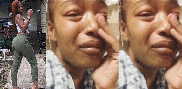 Image result for “Love yourself” Instagram model cries and warns women as she suffer ‘butt implant’ complications