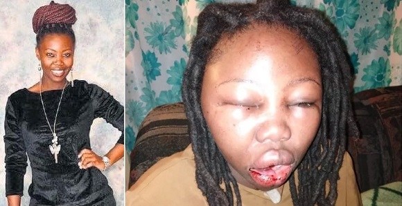 Image result for Actress beaten beyond recognition by her boyfriend for kissing in a movie