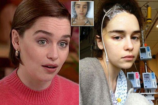 Image result for Game of Thrones star, Emilia Clarke shares photos from hospital as she received treatment for brain aneurysm